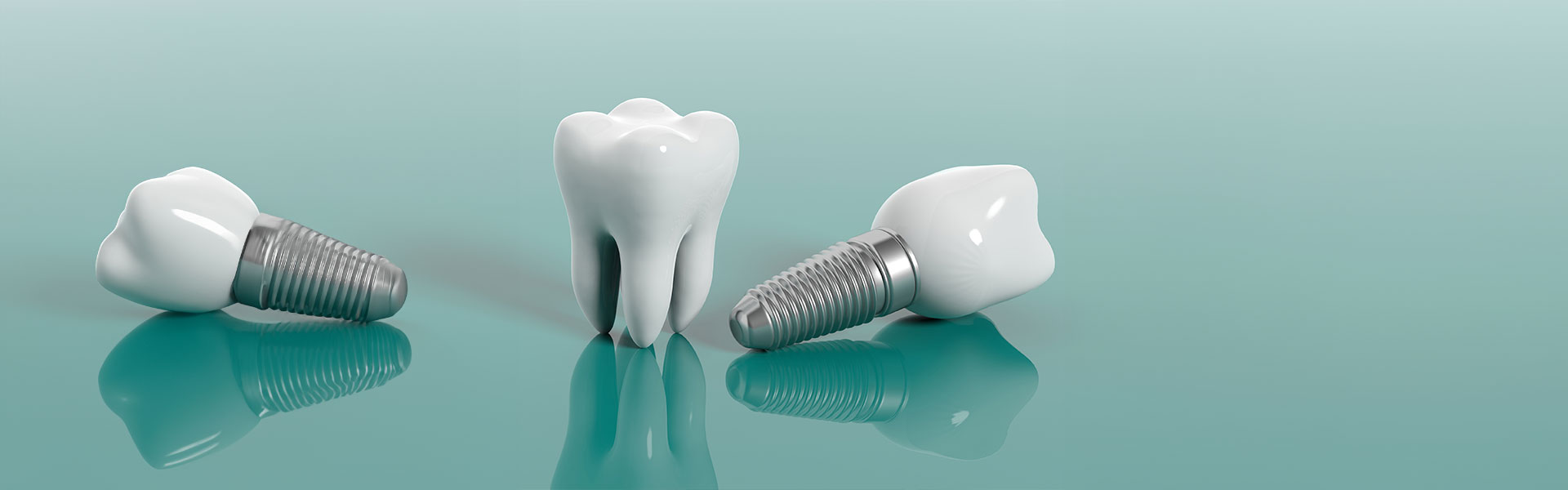 Dental implants new